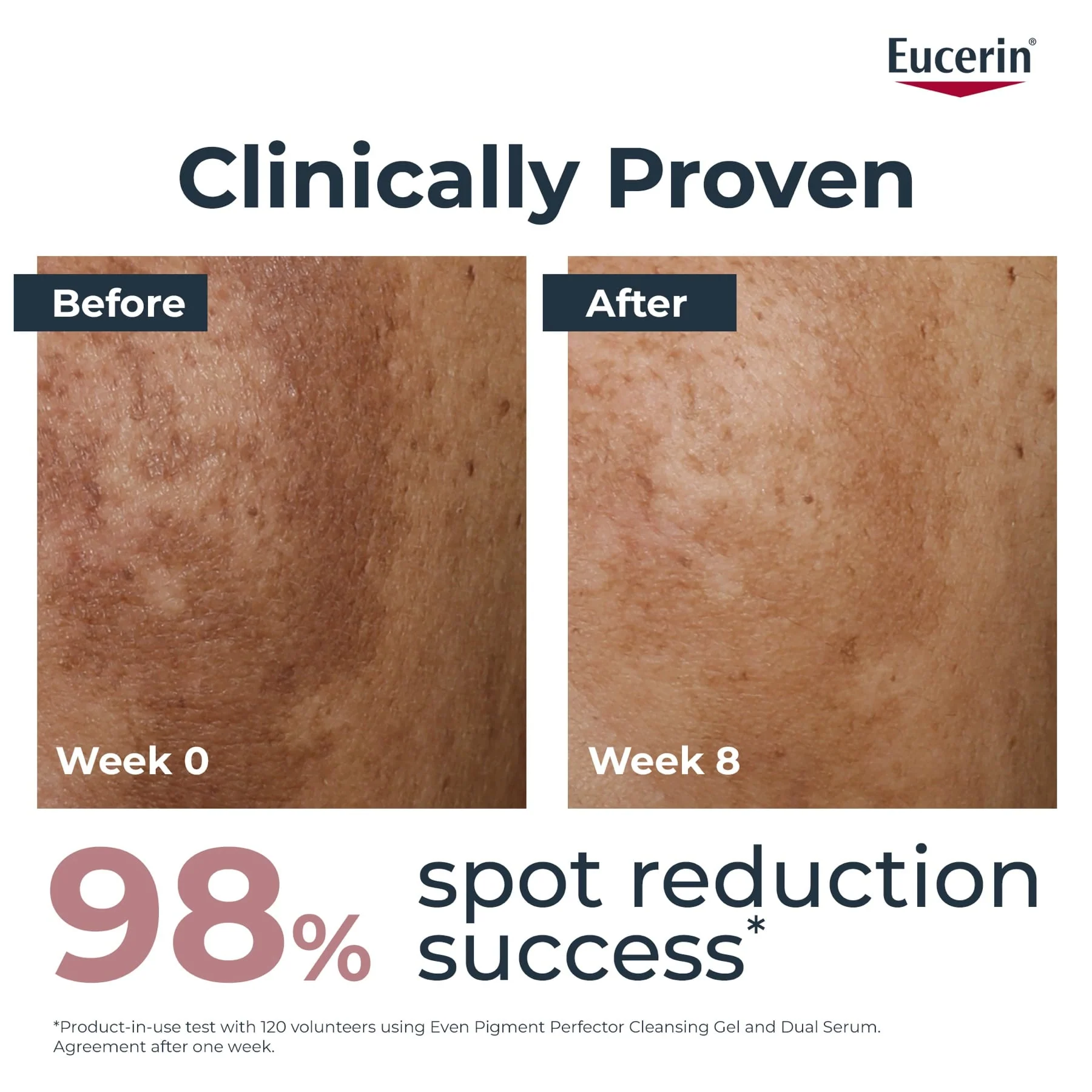 Eucerin Even Pigment Perfector Face Sun Fluid Sunscreen SPF50+ 50ml - Image 9